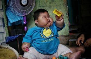 Bayi 27 Kg di Bekasi Jalani Pemeriksaan Dokter